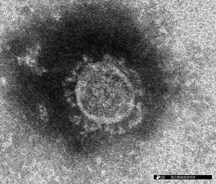新型コロナウイルス – 国立感染症研究所